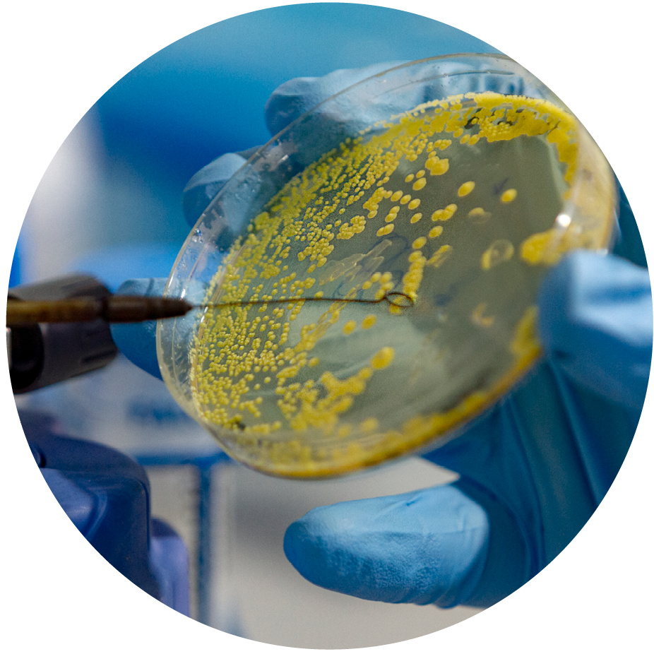 a hand wearing a blue rubber glove holding petri dish with yellow substance growing in it, and a sample tool being used on the substance 
